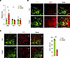 Fasting decreases TET3 expression in AGRP neurons.