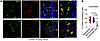 C5aR1 is expressed in macrophages and neutrophils in the lung tissue of pat