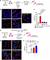 C5a is able to directly promote and enhance SARS-CoV-2-induced NETosis.