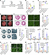 CARDINAL overexpression attenuates cardiomyocyte hypertrophy.