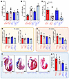 Contractile dysfunction is rescued in Dsg2mut/mut × Ccr2–/– mice via NFκB-i