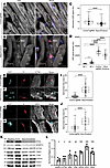 Rpsa knockout disrupts local sarcomeric protein translation and sarcomere i