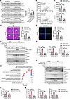 ZBP1 is increased in steatotic livers, underlying its specificity in promot