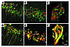 ΔTau colocalizes with pathological features of a triple-transgenic model of