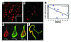ΔTau is found predominantly within AD brain and is inversely correlated wit