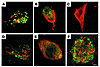 Caspase activation and intracellular Aβ colocalize with ΔTau in the AD brai