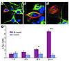 Treatment of cortical neurons with Aβ leads to increased ΔTau immunoreactiv