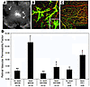 Src kinase antagonists reduce laser-induced retinal vascular permeability.