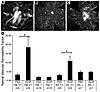 Src–/– and Yes–/– mice are resistant to VEGF-induced retinal vascular perme