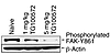 TG100572 inhibits FAK-Y861 phosphorylation during developmental angiogenesi