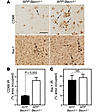 Microglial changes in APP+Becn1+/– mice.