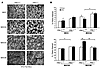 MKP-1 mediates a glycolytic fiber type switch in obesity.