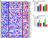 SRF pathway is enriched in skeletal muscle from humans with diabetes or dia