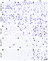 Key insulin signaling molecules seen immuno­histochemically in CA1 neurons