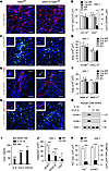 Reduced lymphocyte infiltration in GfapCre:Vegfafl/fl mice.