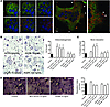 MCV-ACPAs stimulate osteoclastogenesis.