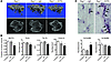 MCV-ACPAs induce bone loss in vivo.