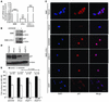 Src inhibition induces an upregulation of nuclear p27 that is reduced and p