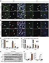 Darinaparsin induces myofibroblast-specific cell-cycle arrest, but does not