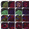 Distribution of liraglutide594 or exendin(9-39)594 in pancreas