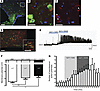 Neuronal accumulation and activity following GLP-1R stimulatio