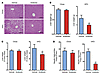 Antibiotic treatment ameliorates the development of NAFLD.