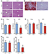 Intestine-specific Fxr disruption protects against HFD-induced