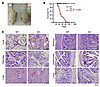 Foxp3-Cre–mediated Hsp90b1 deletion in mice causes a fatal inflammatory dis