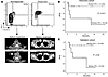 Relative abundance of CTLA-4hiPD-1hi CTLs predicts response to anti–PD-1 th