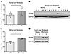 Fibrotic fibroblasts exhibit increased FOXM1 expression.