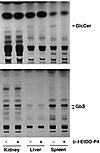 Effect of 3-day treatment with D-t-EtDO-P4 on glucosylceramide and Gb3 cont