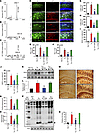After intranasal delivery, WT TIDM peptide enters into the hippocampus and