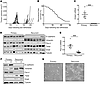 Recurrent tumors downregulate Par-4 and undergo EMT.