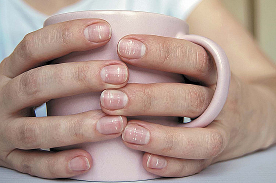 Why do I have white spots on my nails? featured image