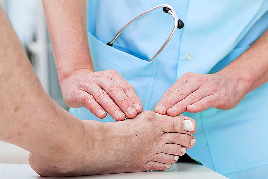 What to do about bunions featured image