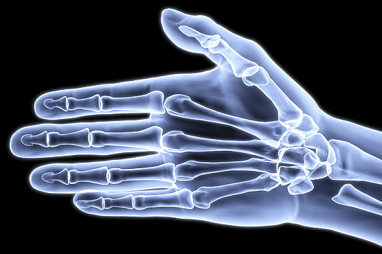 Dupuytren's contracture of the hand featured image