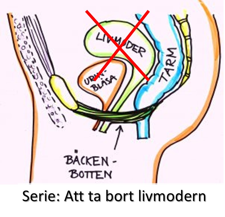 Livet Efter Hysterektomi Bakingbabies