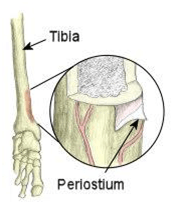 Shin Splints (2)