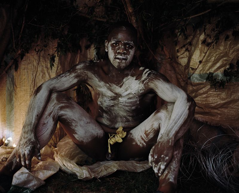 circumcision1