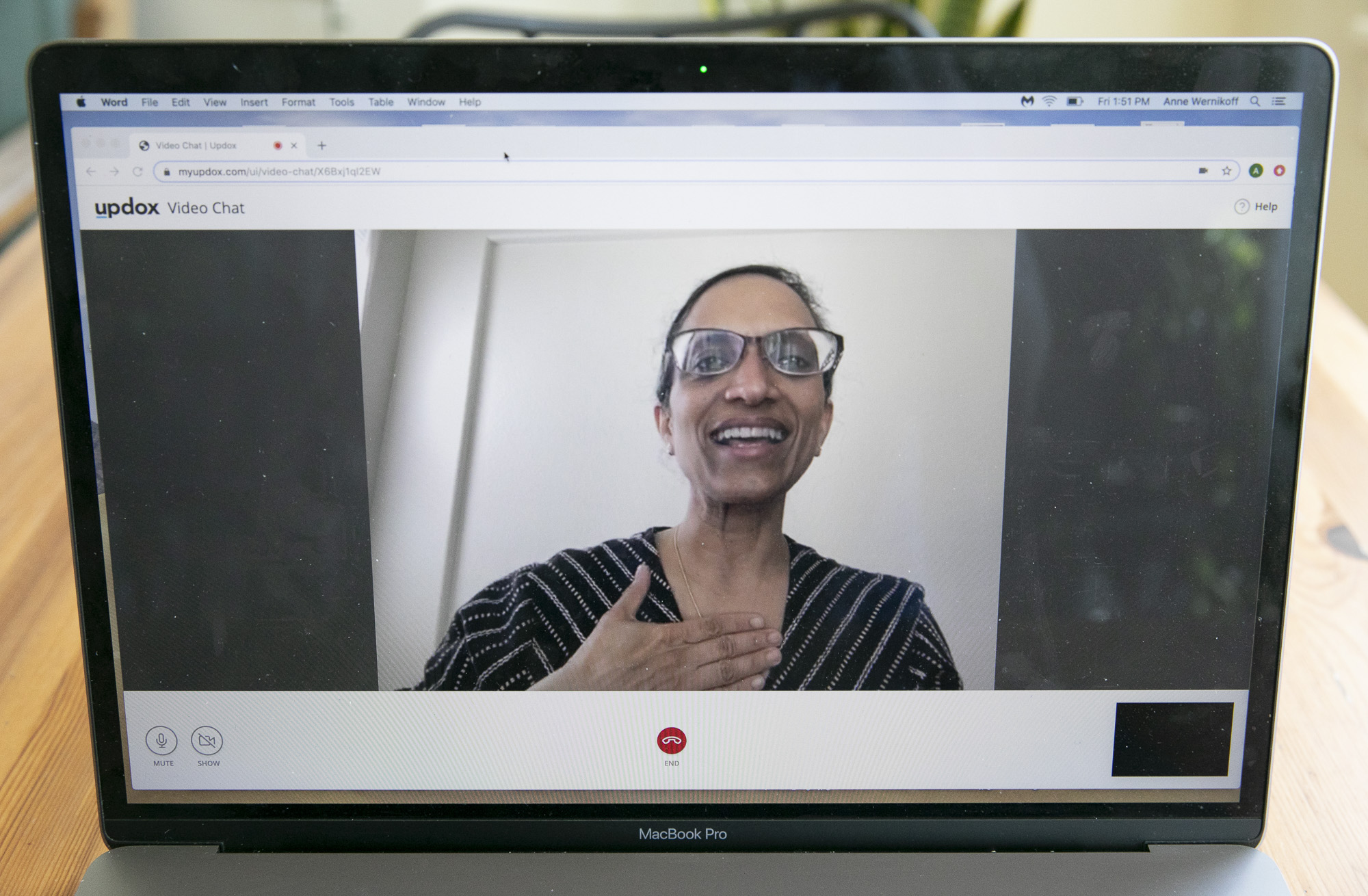 Dr. Sumana Reddy demonstrates a Telehealth exam using Updox, a HIPPA-compliant video chat software, one of several programs her clinic relies on to meet with patients.