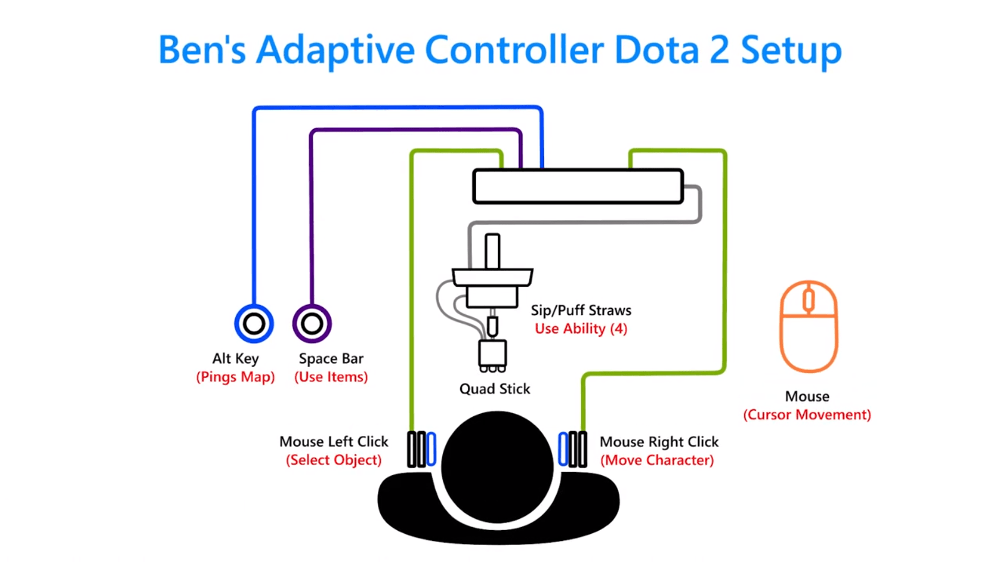 A colorful diagram of Ben's Adaptive Controller setup, showing the arrangement of buttons, Quad Stick and mouse he uses to play Dota 2.