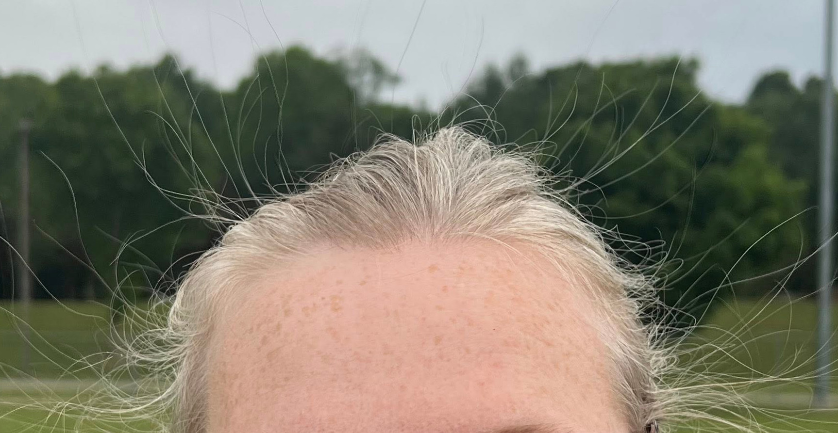 A woman's hair begins to stand on end at Randolph Park in Dublin on Friday, June 13. Several people in the group noticed their hair standing on end and abandoned the event for their automobiles, as this is often a sign lightning may be about to strike. Courtesy of the Wright family.