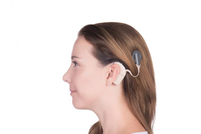 [cochlear implant]