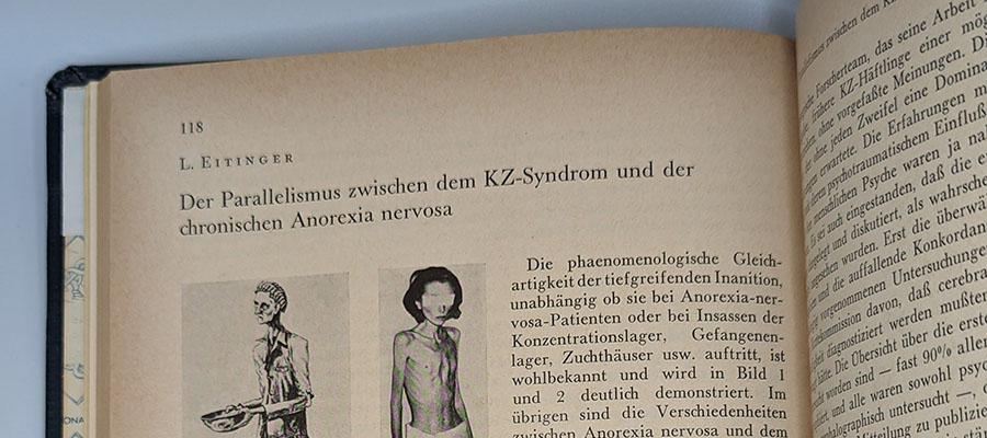 A printed page from a book in German with two illustrations of anorexia nervosa.