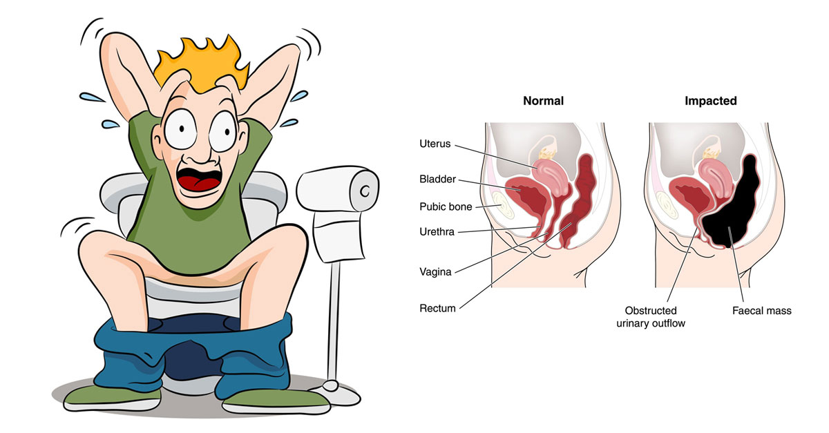 Quick Natural Remedies For Constipation