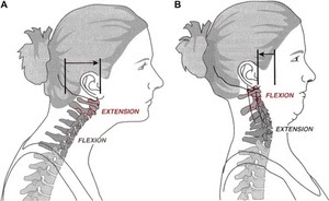 Exercise Strengthen Neck Muscles