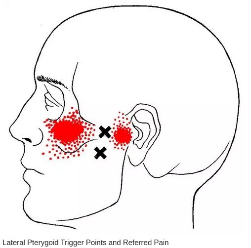 What Causes A Headache Cascade Chiropractic Wellness