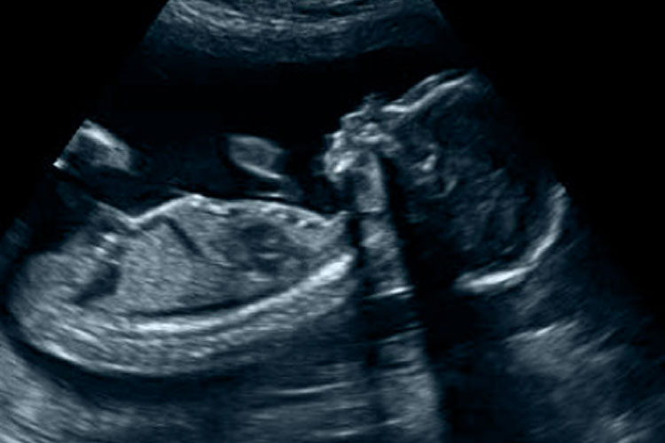 20 Weken Echo Limburg Echocentrum Het Lichtpunt