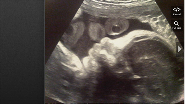 Shakira, Gerard Pique, Baby Sonogram, Barcelona.