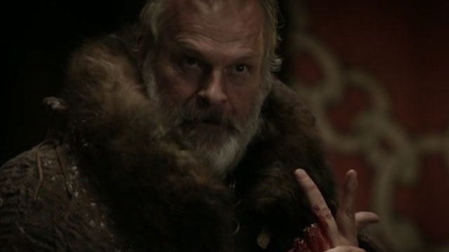 Clive Mantle Attacked Clive Mantle Ear Bitten Off Game of Thrones actor attacked Game of Thrones actor ear bitten. 